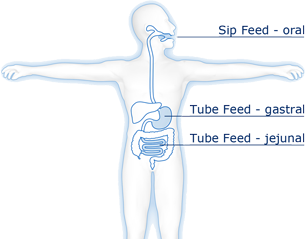 La nutrición enteral usa el tracto gastrointestinal. 