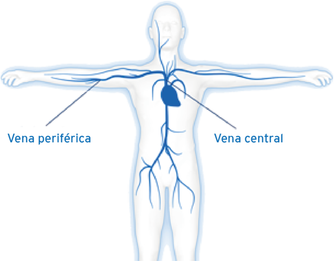 Parenteral nutrition avoids the gastrointestinal tract