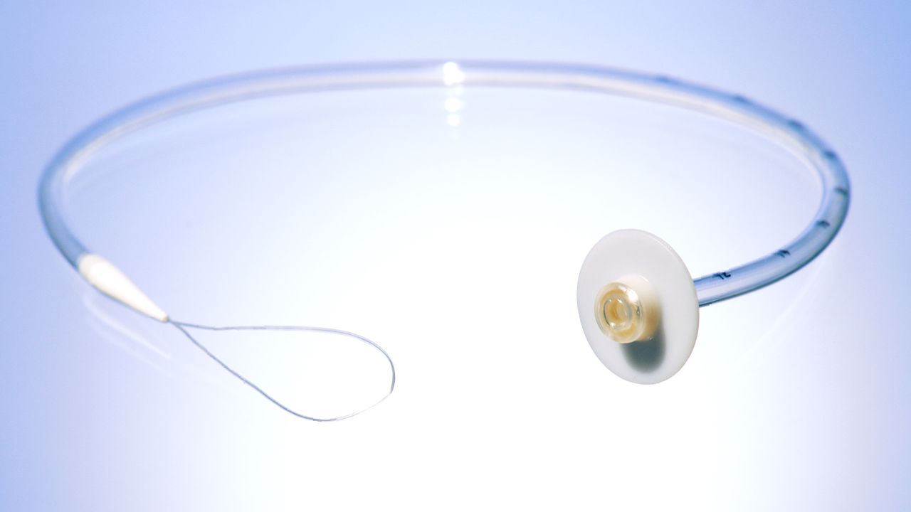 freka-peg-gastric-feeding-tube