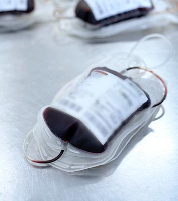Transzfúziós technológia